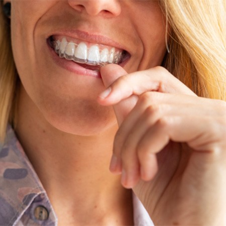 Smiling patient putting on clear aligner